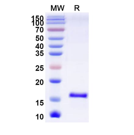 SDS-PAGE - Anti-PrP Nanobody [SAA0870] (A337773) - Antibodies.com
