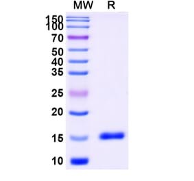 SDS-PAGE - Anti-Thymidine Kinase 1 Nanobody [SAA1373] (A337774) - Antibodies.com