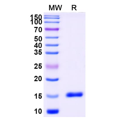 SDS-PAGE - Anti-Thymidine Kinase 1 Nanobody [SAA1373] (A337774) - Antibodies.com