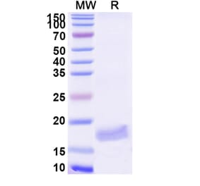 SDS-PAGE - Anti-VWF Nanobody [SAA1195] (A337776) - Antibodies.com