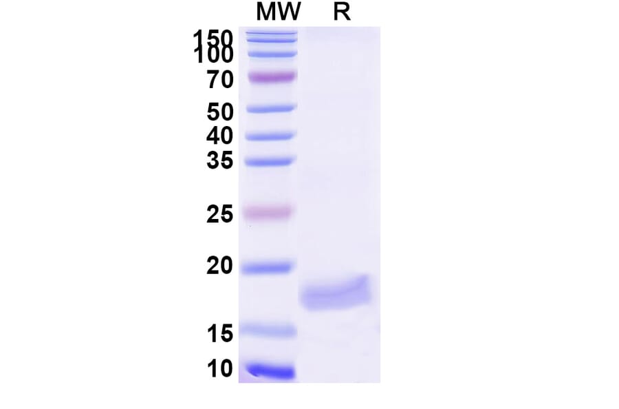 SDS-PAGE - Anti-VWF Nanobody [SAA1195] (A337776) - Antibodies.com