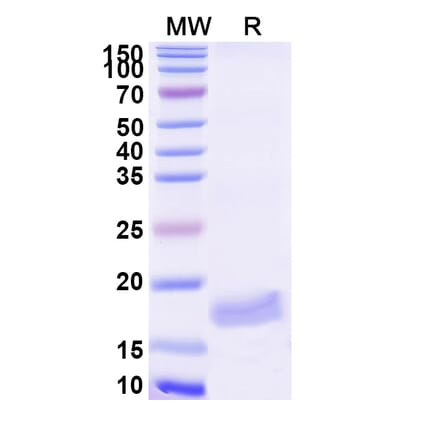 SDS-PAGE - Anti-VWF Nanobody [SAA1195] (A337776) - Antibodies.com