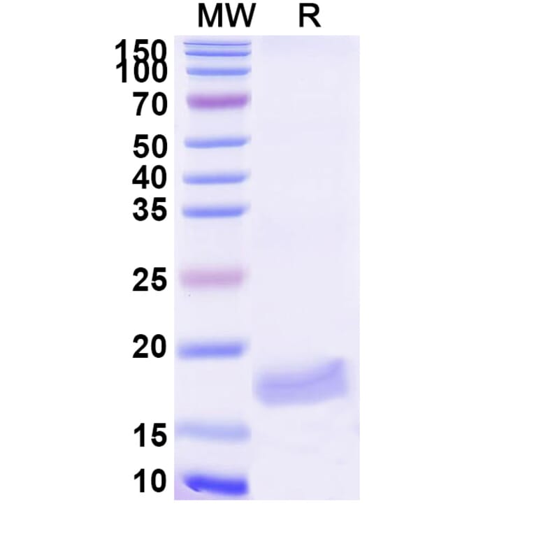 SDS-PAGE - Anti-VWF Nanobody [SAA1195] (A337776) - Antibodies.com