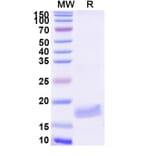 SDS-PAGE - Anti-VWF Nanobody [SAA1195] (A337776) - Antibodies.com