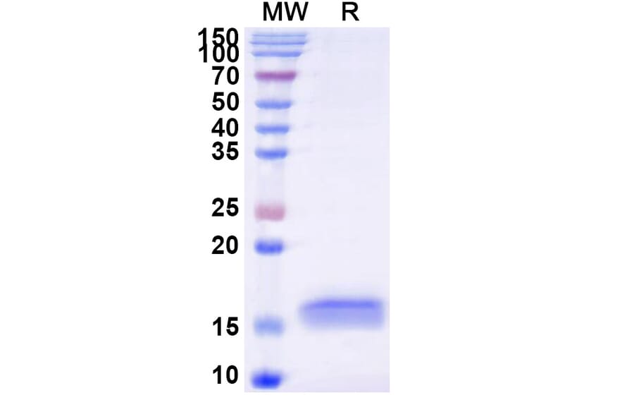SDS-PAGE - Anti-APP Nanobody [SAA1209] (A337781) - Antibodies.com
