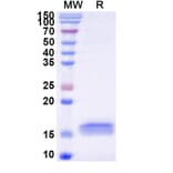 SDS-PAGE - Anti-APP Nanobody [SAA1209] (A337781) - Antibodies.com