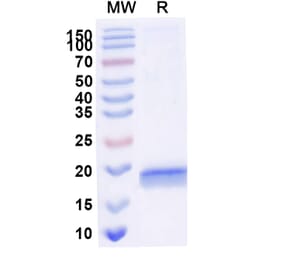 SDS-PAGE - Anti-PAI 1 Nanobody [SAA1078] (A337783) - Antibodies.com
