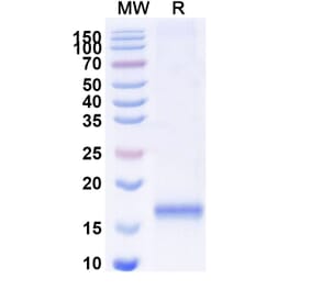 SDS-PAGE - Anti-PAI 1 Nanobody [SAA1098] (A337785) - Antibodies.com