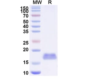 SDS-PAGE - Anti-Integrin beta 1 Nanobody [SAA1306] (A337788) - Antibodies.com