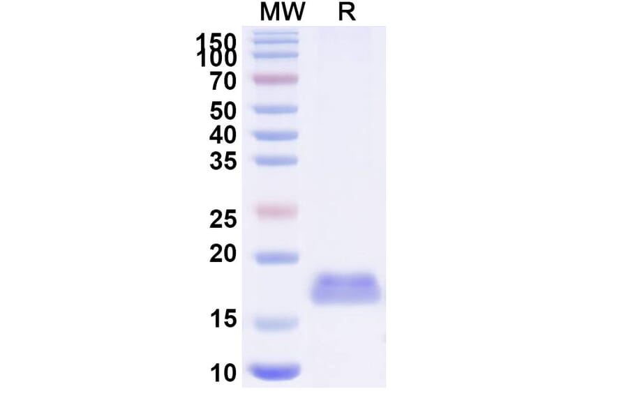 SDS-PAGE - Anti-Integrin beta 1 Nanobody [SAA1306] (A337788) - Antibodies.com
