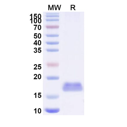 SDS-PAGE - Anti-Integrin beta 1 Nanobody [SAA1306] (A337788) - Antibodies.com