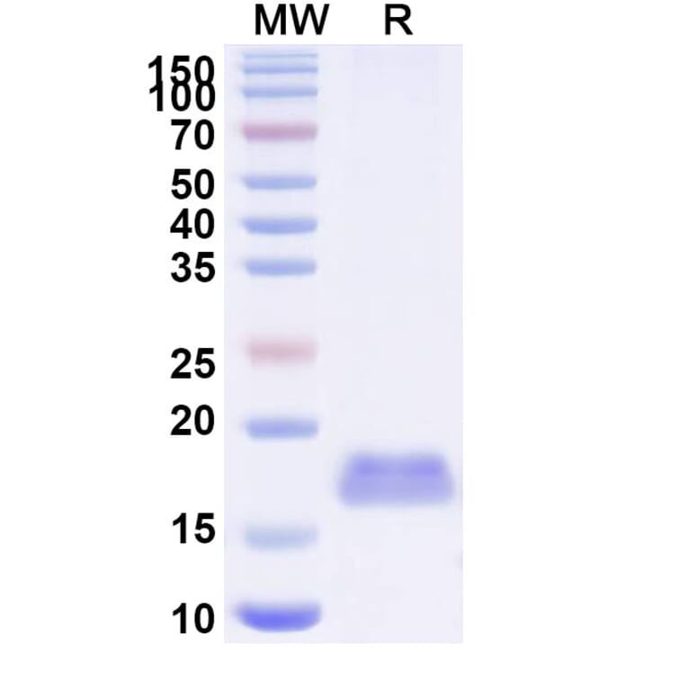 SDS-PAGE - Anti-Integrin beta 1 Nanobody [SAA1306] (A337788) - Antibodies.com