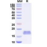 SDS-PAGE - Anti-Integrin beta 1 Nanobody [SAA1306] (A337788) - Antibodies.com