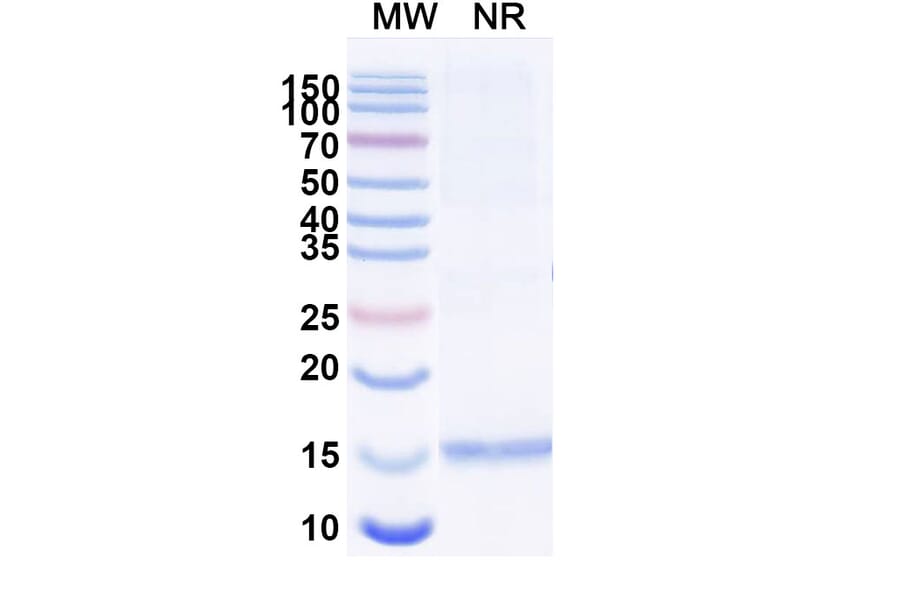 SDS-PAGE - Anti-Gelsolin Nanobody [SAA1179] (A337789) - Antibodies.com