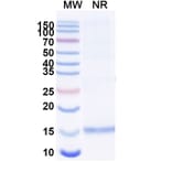 SDS-PAGE - Anti-Gelsolin Nanobody [SAA1179] (A337789) - Antibodies.com