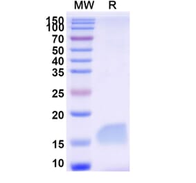 SDS-PAGE - Anti-Gelsolin Nanobody [SAA1010] (A337791) - Antibodies.com