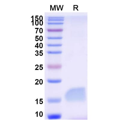 SDS-PAGE - Anti-Gelsolin Nanobody [SAA1010] (A337791) - Antibodies.com