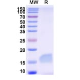 SDS-PAGE - Anti-Gelsolin Nanobody [SAA1010] (A337791) - Antibodies.com