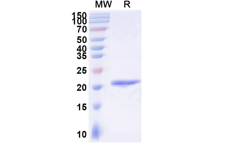 SDS-PAGE - Anti-Gelsolin Nanobody [SAA1011] (A337792) - Antibodies.com