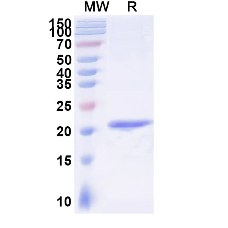 SDS-PAGE - Anti-Gelsolin Nanobody [SAA1011] (A337792) - Antibodies.com