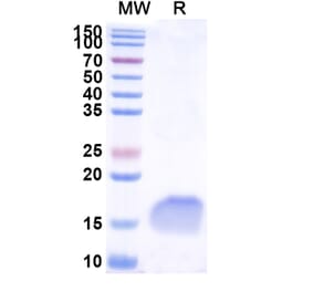 SDS-PAGE - Anti-CEA Nanobody [SAA1298] (A337793) - Antibodies.com
