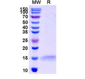 SDS-PAGE - Anti-ADRB2 Nanobody [SAA1252] (A337795) - Antibodies.com