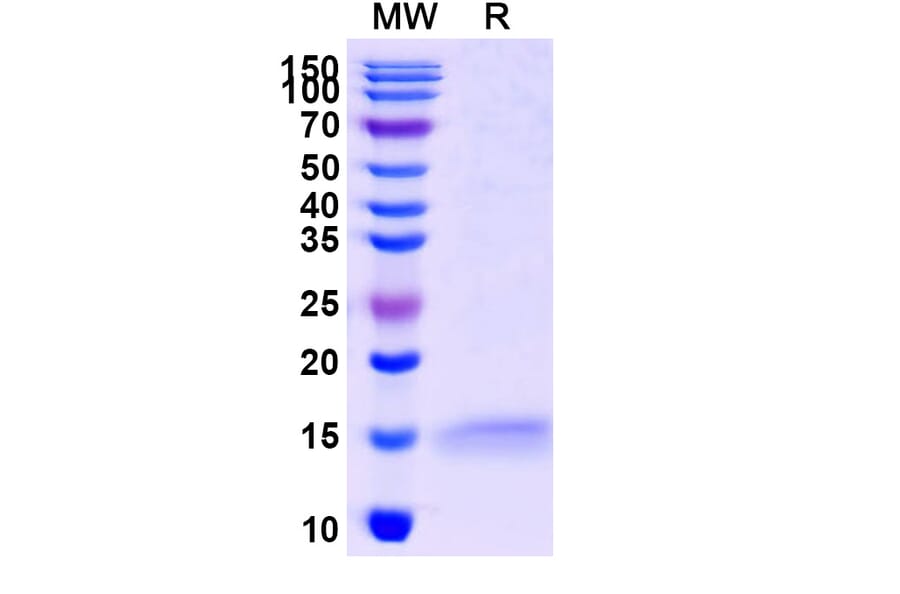 SDS-PAGE - Anti-ADRB2 Nanobody [SAA1252] (A337795) - Antibodies.com