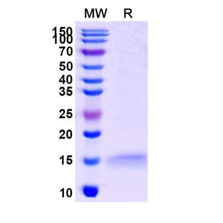 SDS-PAGE - Anti-ADRB2 Nanobody [SAA1252] (A337795) - Antibodies.com