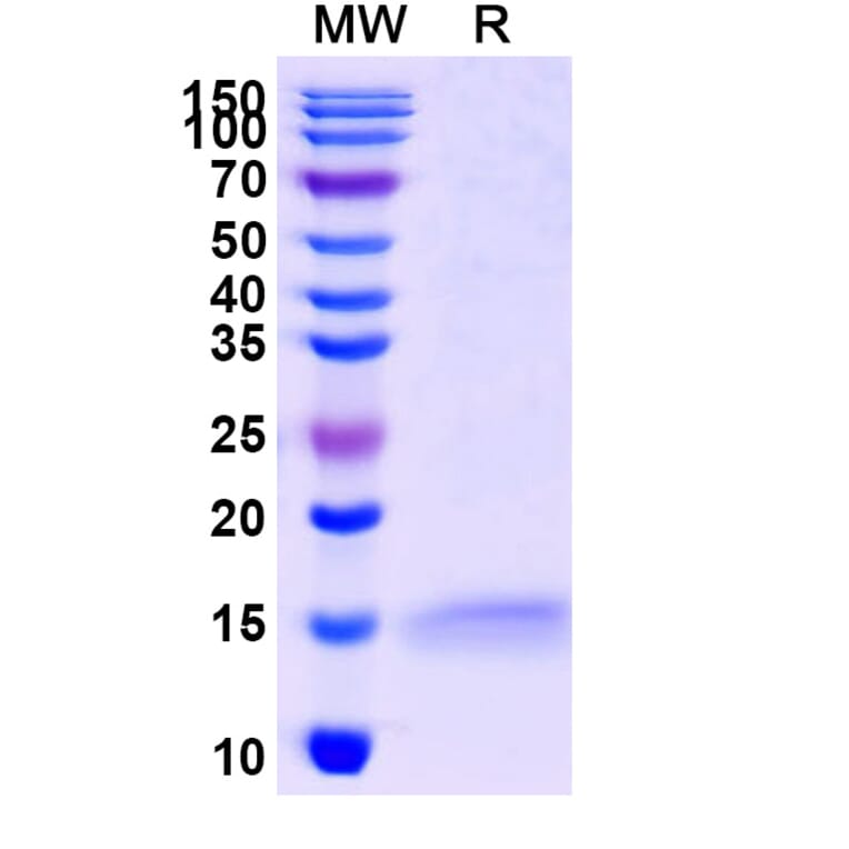 SDS-PAGE - Anti-ADRB2 Nanobody [SAA1252] (A337795) - Antibodies.com