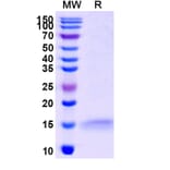 SDS-PAGE - Anti-ADRB2 Nanobody [SAA1252] (A337795) - Antibodies.com