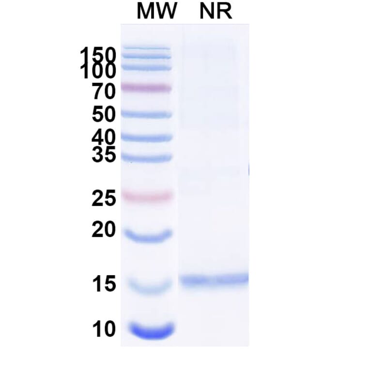 SDS-PAGE - Anti-CD3 epsilon Nanobody [SAA1330] (A337798) - Antibodies.com