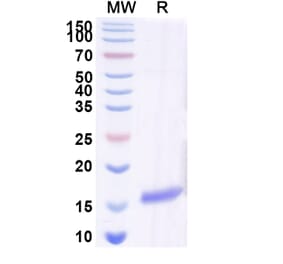 SDS-PAGE - Anti-CHRM2 Nanobody [SAA0920] (A337801) - Antibodies.com
