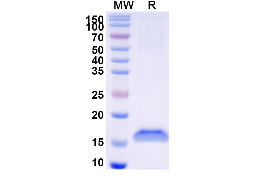 SDS-PAGE - Anti-c-Met Nanobody [SAA1308] (A337802) - Antibodies.com