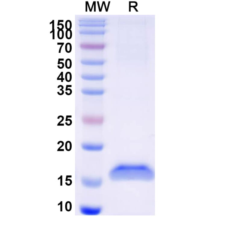 SDS-PAGE - Anti-c-Met Nanobody [SAA1308] (A337802) - Antibodies.com