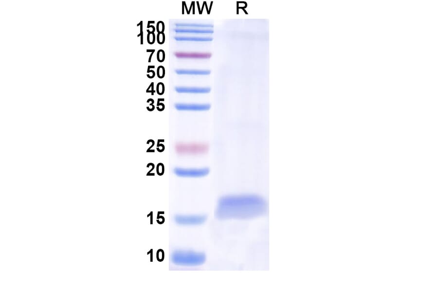 SDS-PAGE - Anti-Integrin alpha 5 Nanobody [SAA1304] (A337803) - Antibodies.com