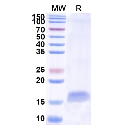 SDS-PAGE - Anti-Integrin alpha 5 Nanobody [SAA1304] (A337803) - Antibodies.com