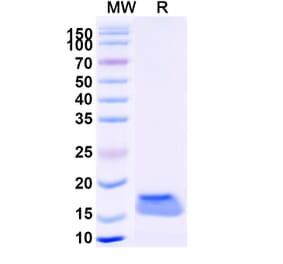 SDS-PAGE - Anti-Vimentin Nanobody [SAA1226] (A337804) - Antibodies.com