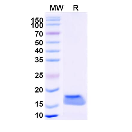 SDS-PAGE - Anti-Vimentin Nanobody [SAA1226] (A337804) - Antibodies.com
