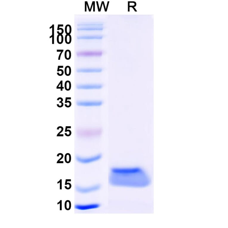 SDS-PAGE - Anti-Vimentin Nanobody [SAA1226] (A337804) - Antibodies.com
