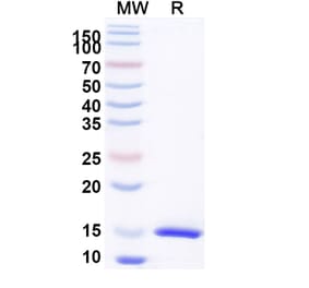 SDS-PAGE - Anti-CD126 Nanobody [SAA1278] (A337806) - Antibodies.com