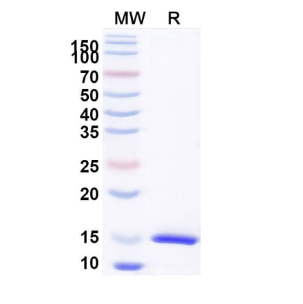 SDS-PAGE - Anti-CD126 Nanobody [SAA1278] (A337806) - Antibodies.com