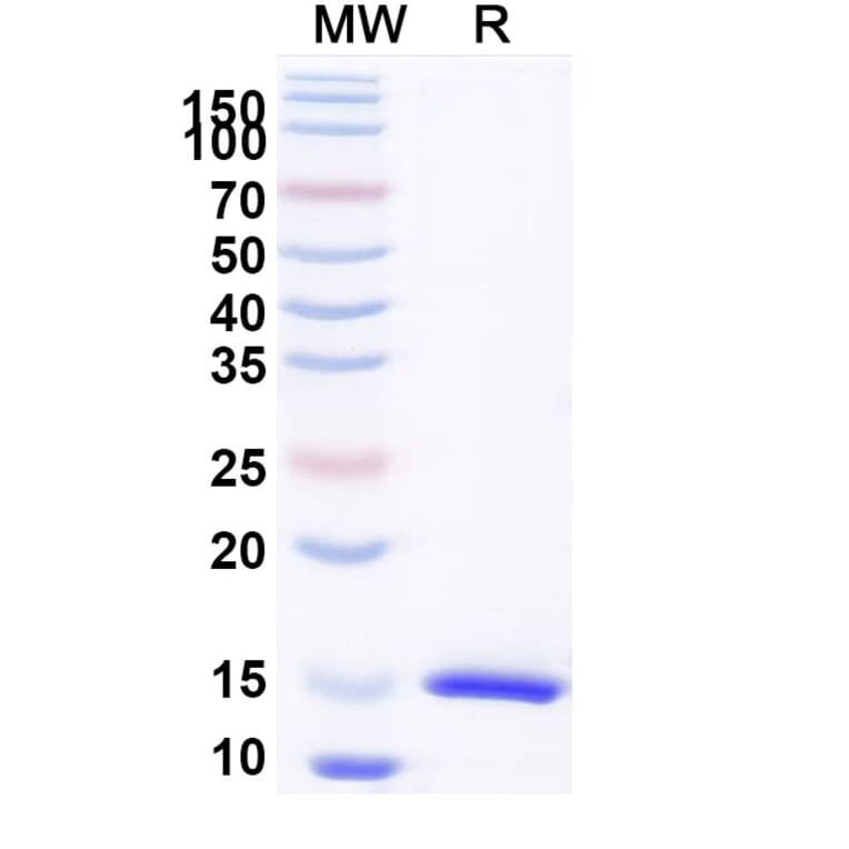 SDS-PAGE - Anti-CD126 Nanobody [SAA1278] (A337806) - Antibodies.com