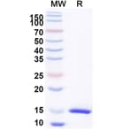 SDS-PAGE - Anti-CD126 Nanobody [SAA1278] (A337806) - Antibodies.com