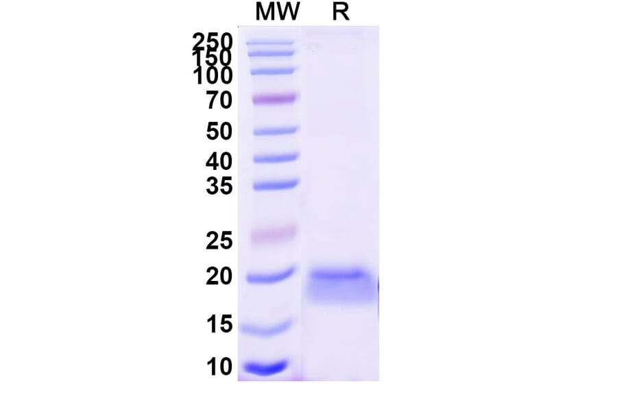 SDS-PAGE - Anti-CD7 Nanobody [SAA1260] (A337807) - Antibodies.com