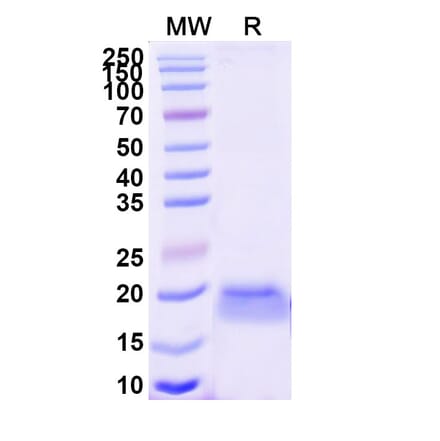 SDS-PAGE - Anti-CD7 Nanobody [SAA1260] (A337807) - Antibodies.com