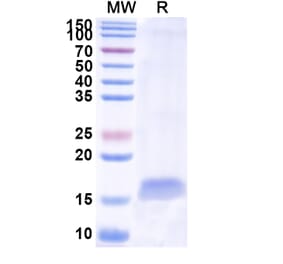 SDS-PAGE - Anti-Furin Nanobody [SAA1044] (A337809) - Antibodies.com