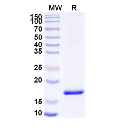 SDS-PAGE - Anti-C4 Nanobody [SAA0908] (A337810) - Antibodies.com