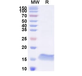 SDS-PAGE - Anti-Bcl-2 Nanobody [SAA1206] (A337813) - Antibodies.com