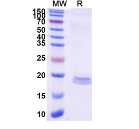 SDS-PAGE - Anti-MCP 1 Nanobody [SAA1269] (A337820) - Antibodies.com