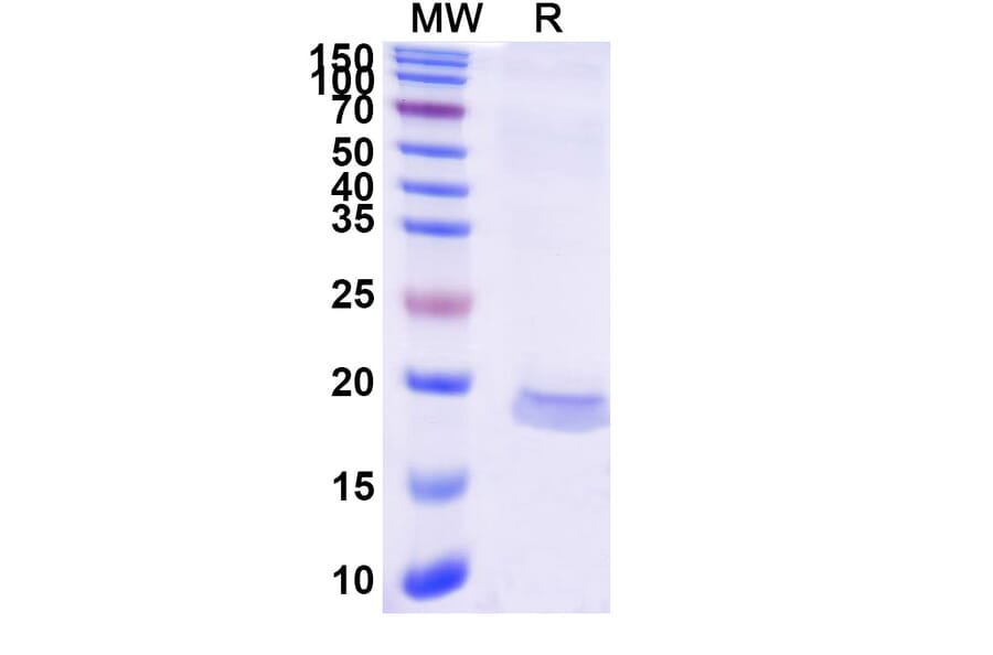 SDS-PAGE - Anti-MCP 1 Nanobody [SAA1269] (A337820) - Antibodies.com
